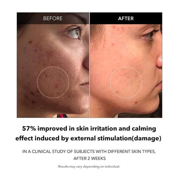 APRILSKIN Carrotene Clarifying Foam Cleanser-Vegan,Cruelty Free! Korean Skincare - Picture 4 of 8